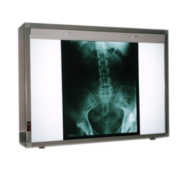 Негатоскоп НЕГА Н-РМ-01, Россия.